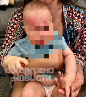 В Балашихе мужчина и его семья пострадали от нападения соседей