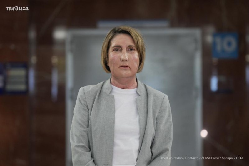 В Испании пересадили лицо женщине, донор которой согласилась на пожертвование перед уходом из жизни