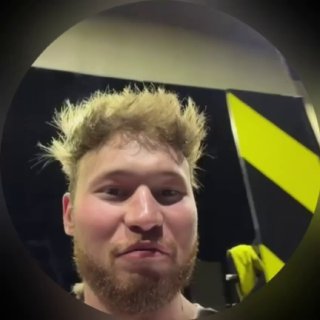 Иван Золо показал свои волосы на теле