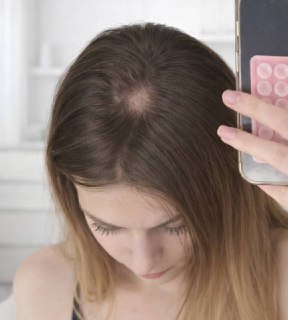 Москвичка заразилась грибком после примерки шапки