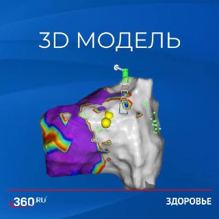 В России успешно вылечили сердце девочки точечным ударом тока