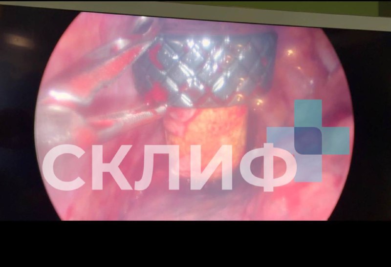 Пробка от коньяка в легком