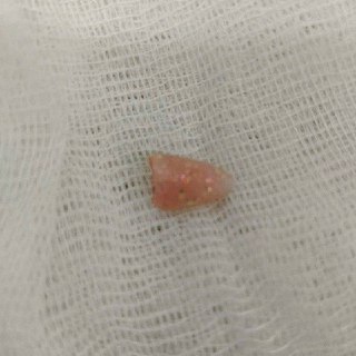 Маникюр матери чуть не убил младенца