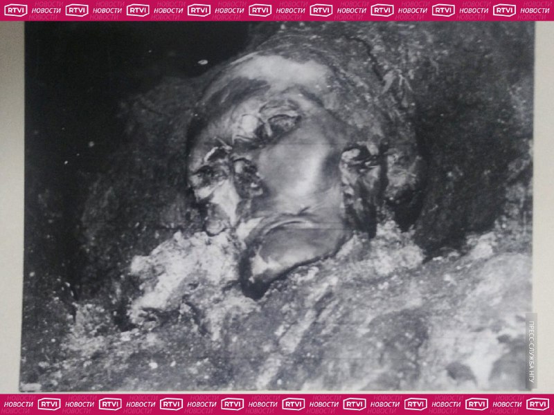 Древняя операция на челюсти