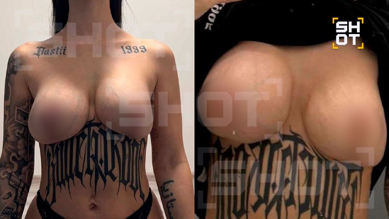 Пациентки обвиняют хабаровского хирурга в изуродовании тел