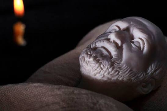 Лицо Гиппократа: классический медицинский симптом