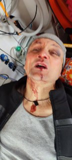 Избиение инвалида-военного в Харькове