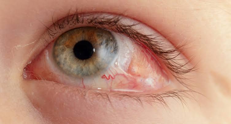 Отслоение сетчатки при взрывной травме: причины, симптомы и лечение