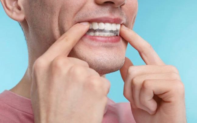 Российские ученые изобрели жвачку от кариеса