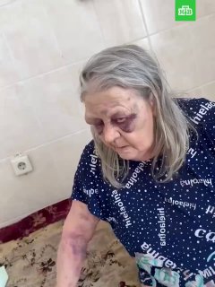 Пенсионерку избили в больнице в Кемеровской области