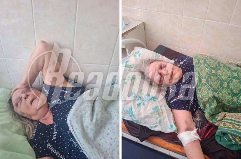 В Кузбассе расследуют появление гематом у пожилой пациентки в больнице