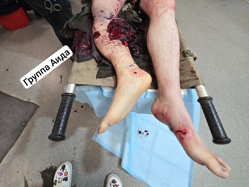 Пожелаем нашему разведчику Миражу выздоровления