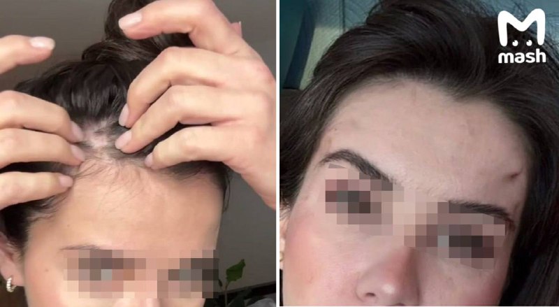 Хирурга элитной клиники обвинили в домогательствах после неудачной операции