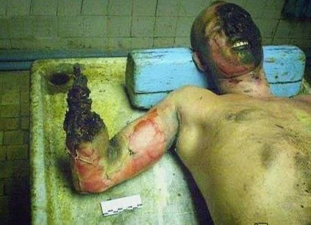 Электротравмы на фронте: опасность, механизмы поражения и алгоритмы спасения