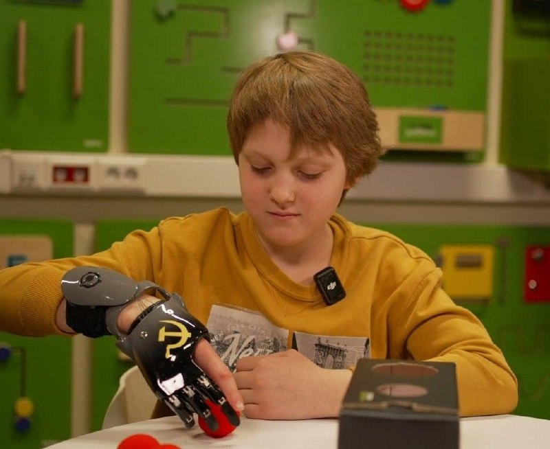 Мальчику из Красногорска установили 3D-протез после взрыва