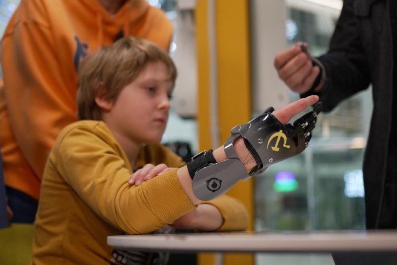 Мальчику, пострадавшему от взрыва в Красногорске, сделали индивидуальный протез пальцев