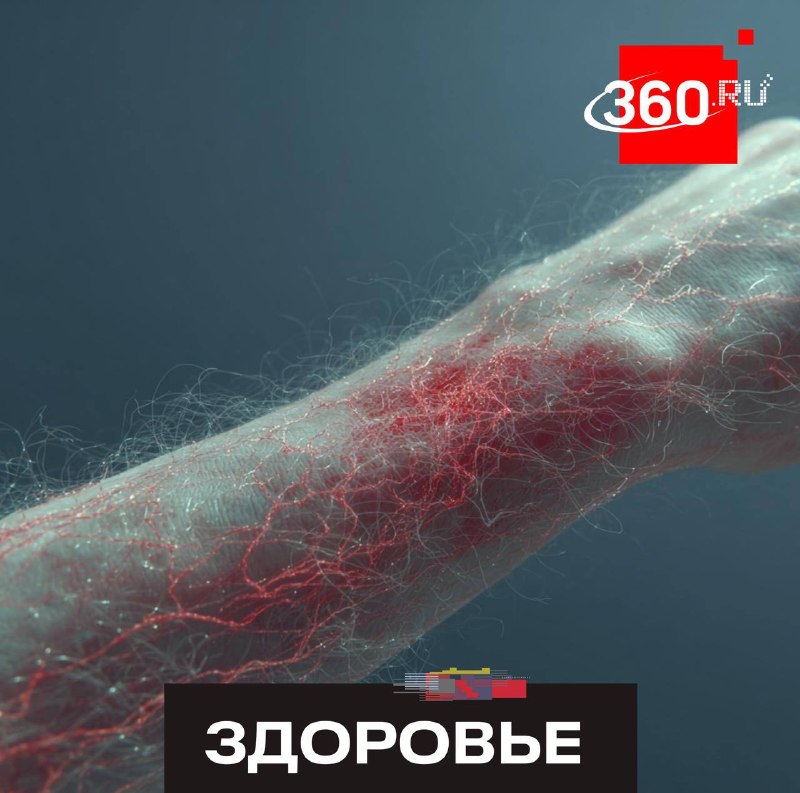 Стресс может вызывать обострение экземы, выяснили ученые