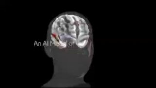 Meta создала ИИ для предсказания реакции мозга на контент