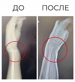 Подмосковные врачи спасли подростка после неудачного свидания