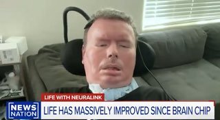 Первый пациент Neuralink заговорил с помощью телепатии