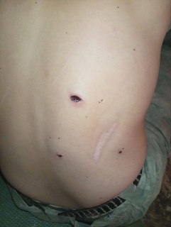 Колонка: Почему взаимопомощь при ранениях в спину спасает жизни на фронте