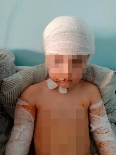 Собаки растерзали пятилетнюю девочку в Диксоне