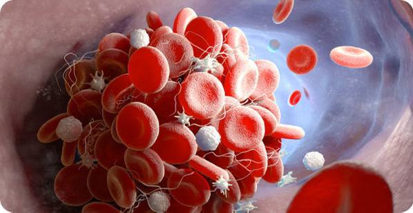 Механизмы и профилактика вторичных кровотечений при боевых травмах