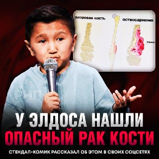 Стендап-комику Элдосу диагностировали рак кости