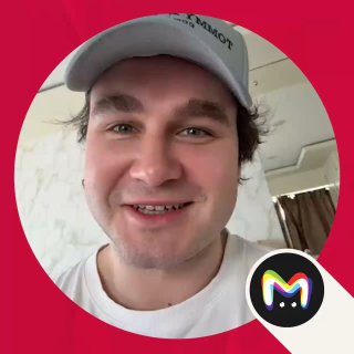 Друг подкаста опроверг слухи о своей пластике