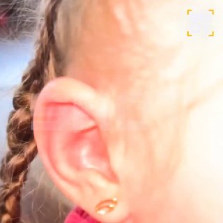 В Тюмени пятилетняя девочка пострадала от укуса энцефалитного клеща