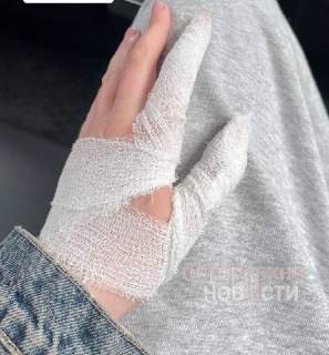 У москвички взорвался пауэрбанк Commo от «Яндекс Фабрики» во время зарядки