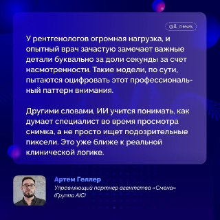 ИИ научили смотреть на рентген почти как врач