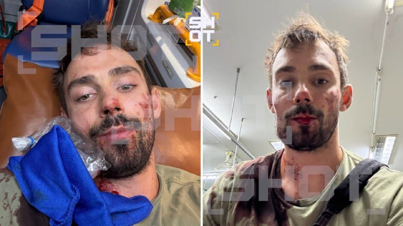 В Таиланде пьяный россиянин избил соотечественника пивной кружкой в ресторане