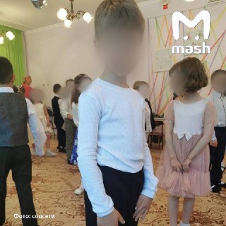 В подмосковном зоопарке косуля напала на 10-летнего ребёнка