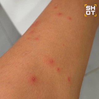 Планктон атакует российских туристов во Вьетнаме