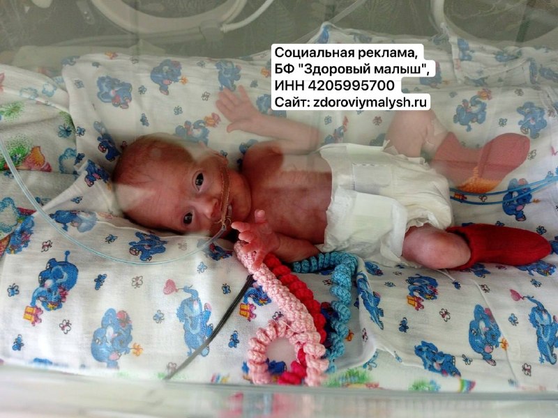 Семья просит помощи на реабилитацию для девочки с ДЦП