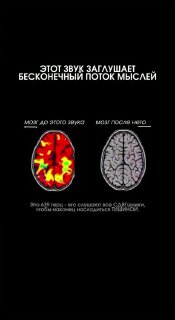 В рилсах вирусится звук для людей с СДВГ, помогающий снизить поток мыслей