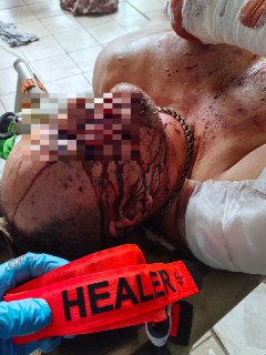 Рекомендации по оказанию помощи при травмах лица и шеи