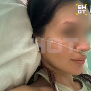 У молодой мамы в Свердловской области развился абсцесс лёгкого из-за использования назального аспиратора
