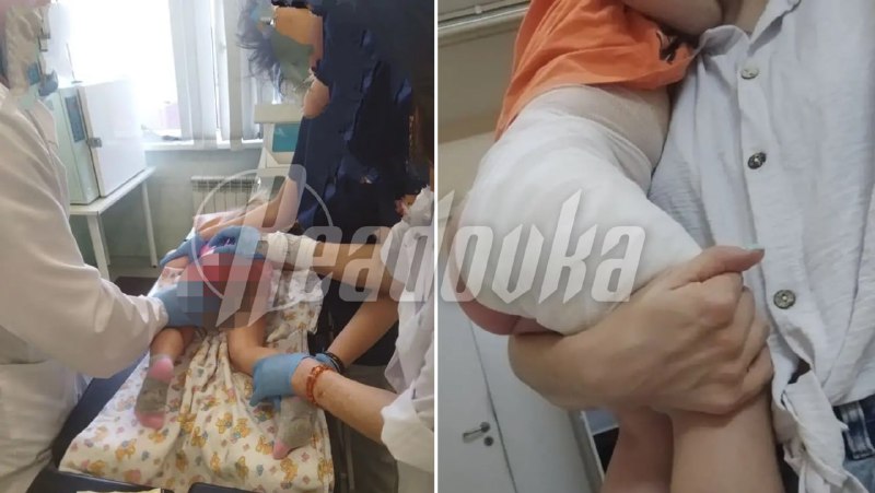 Ребенок получил химический ожог в детском саду в Адлере