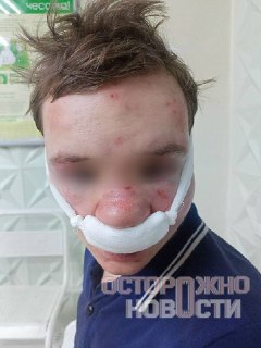 В Сыктывкаре подростки избили парня с инвалидностью и вымогали деньги